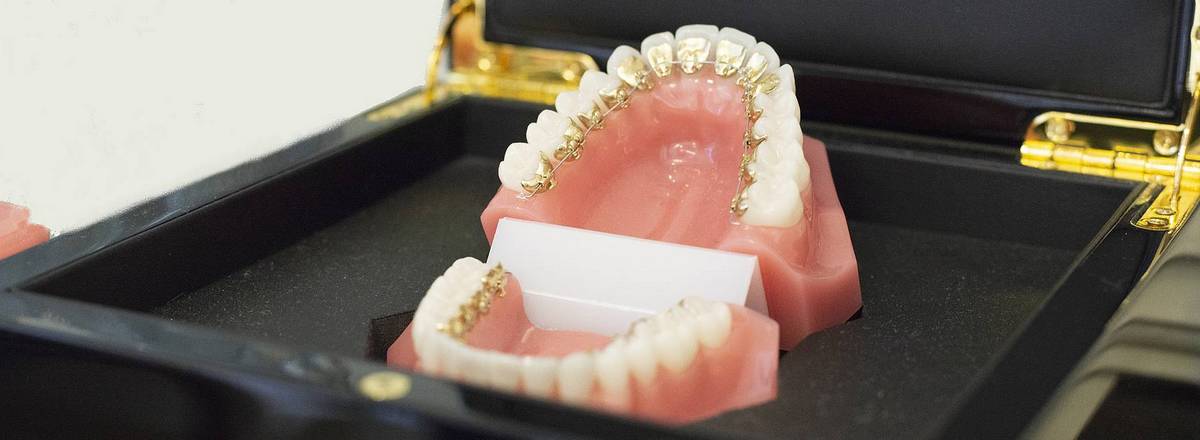 Lingual braces in box at Elgin Dental Care