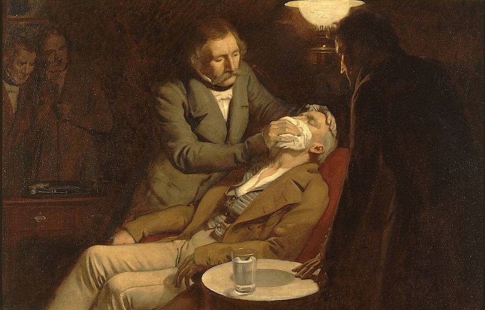 Administering ether as an anaesthetic