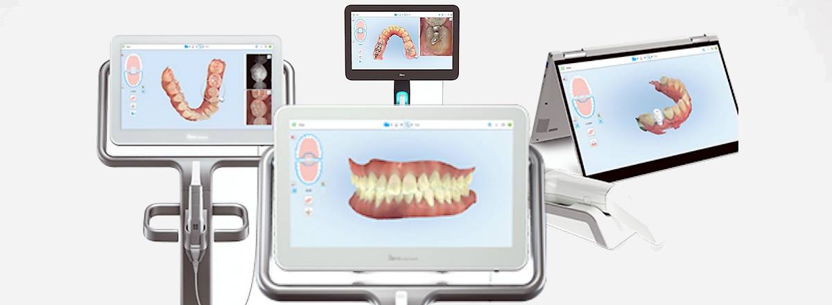 Oral scans on screen